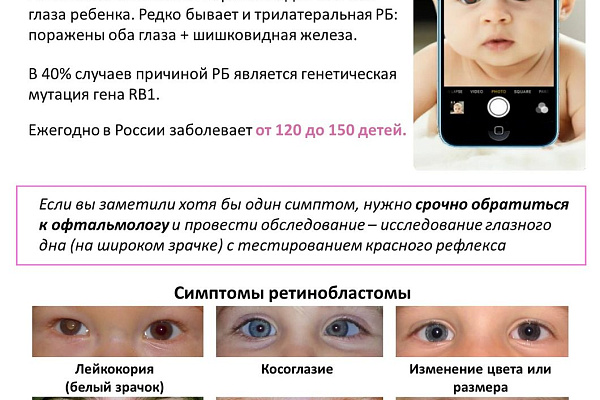 Ретинобластома