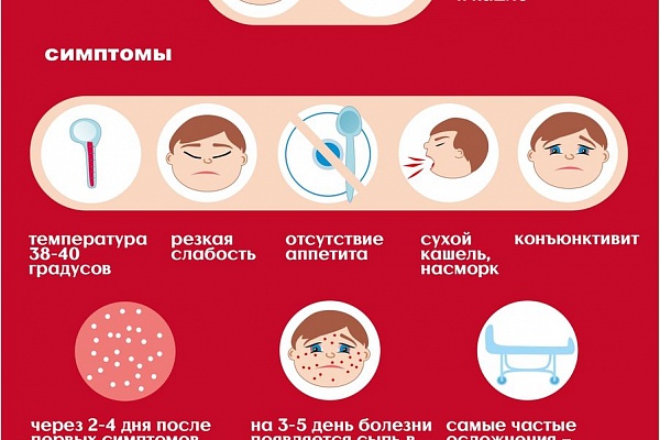 Югорчан призывают защититься от кори
