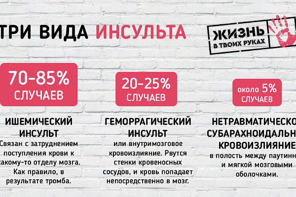 Инсульт – заболевание сосудов головного мозга